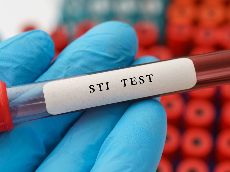 sti test vial