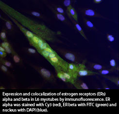 Expression and colocalization of estrogen receptors (ERs) alpha and beta in L6 myotubes by immunofluorescence. ER alpha was stained with Cy3 (red), ER beta with FITC (green) and nucleus with DAPI (blue). 