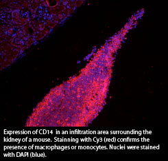 Expression of CD14  in an infiltration area surrounding the kidney of a mouse.  Stainning with Cy3 (red) confirms the presence of macrophages or monocytes. Nuclei were stained with DAPI (blue).