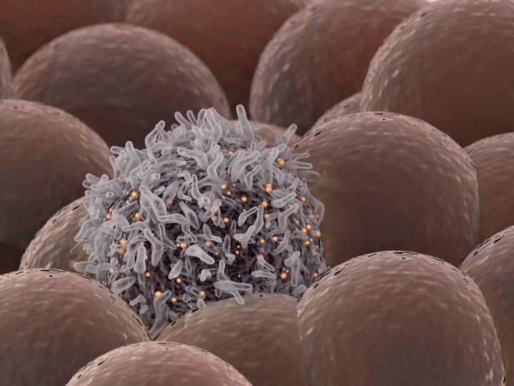 Cancer cell among healthy cells