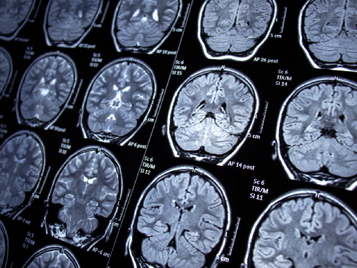 multiple brain scans