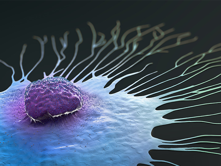Breast Cancer Cell spreading illustration